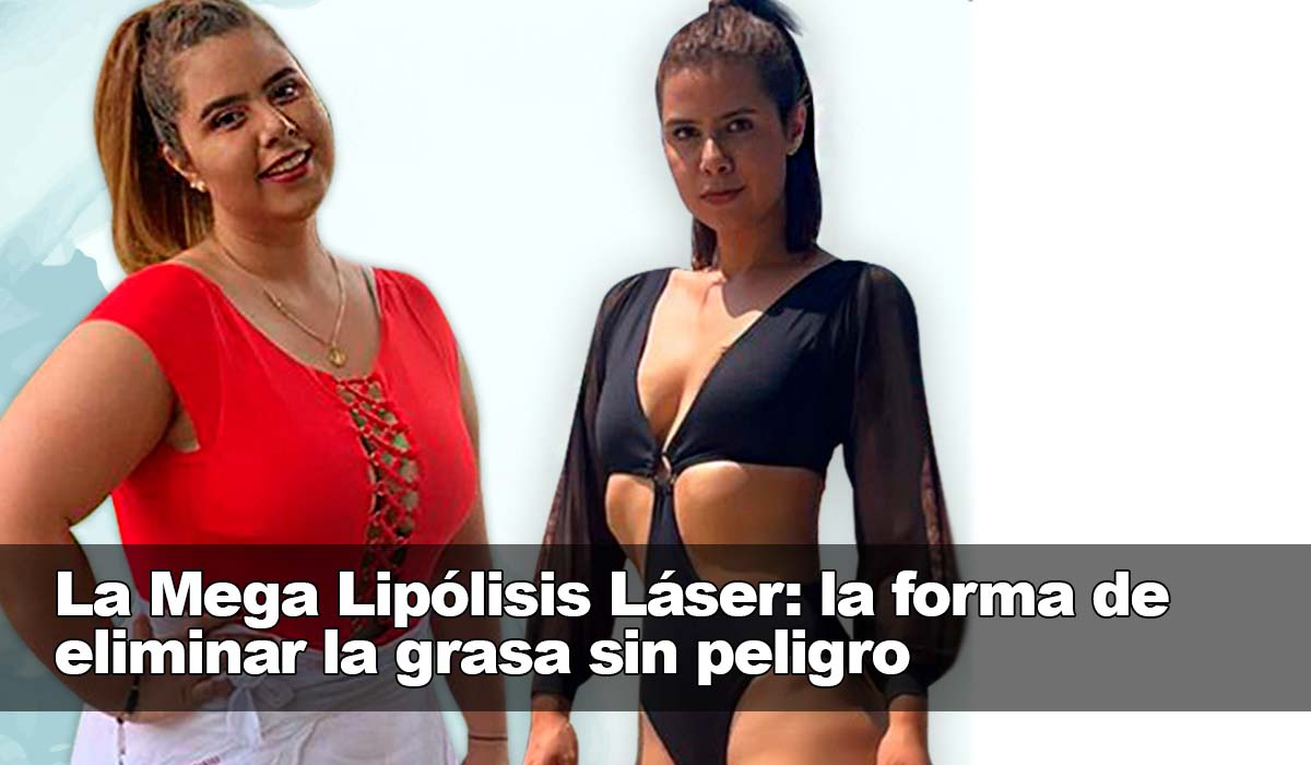 La Mega Lipólisis Láser: la solución para eliminar la grasa sin dolor